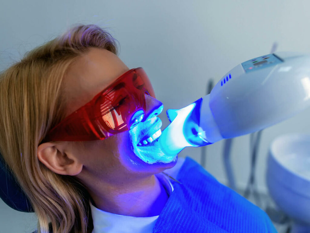 Woman receiving a light activated professional teeth whitening treatment